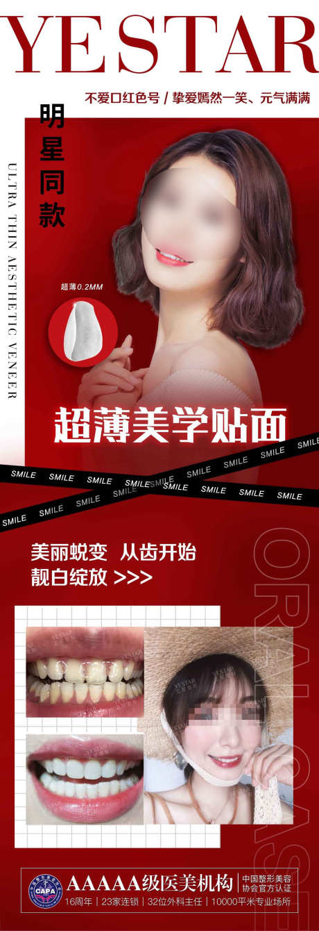 医美口腔宣传图_源文件下载_PSD格式_1352X3937像素-人物,宣传,口腔,贴面,医美,海报-作品编号:2023060417309647-素材库-www.sucai1.cn