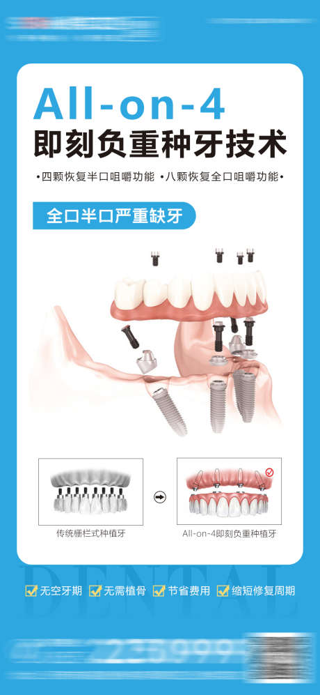 医美口腔种植牙海报_源文件下载_PSD格式_1080X2341像素-宣传,对比图,简约,大气,牙齿,即刻负重,齿科,牙科,海报,种植牙,口腔,医美-作品编号:2023061217568358-志设-zs9.com