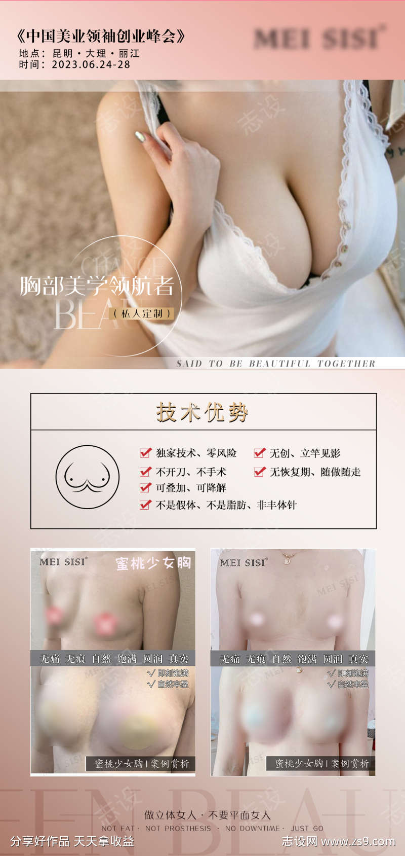 美胸丰胸轻医美