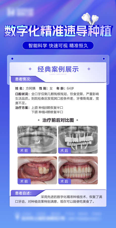 口腔案例海报_源文件下载_PSD格式_750X1465像素-对比,数字化,种植牙,牙齿,海报,案例,口腔-作品编号:2023112916511921-素材库-www.sucai1.cn