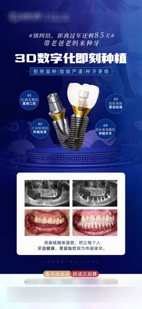 种植牙海报_源文件下载_PSD格式_1080X2340像素-牙科,对比,案例,简约,种植牙,数字化,口腔,医疗,海报-作品编号:2023122810165493-志设-zs9.com