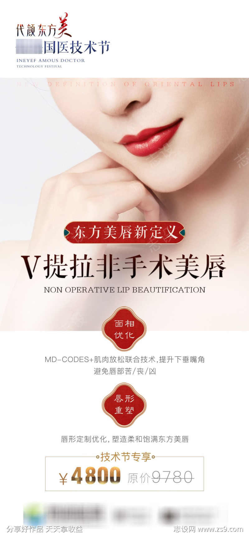 医美V拉美唇