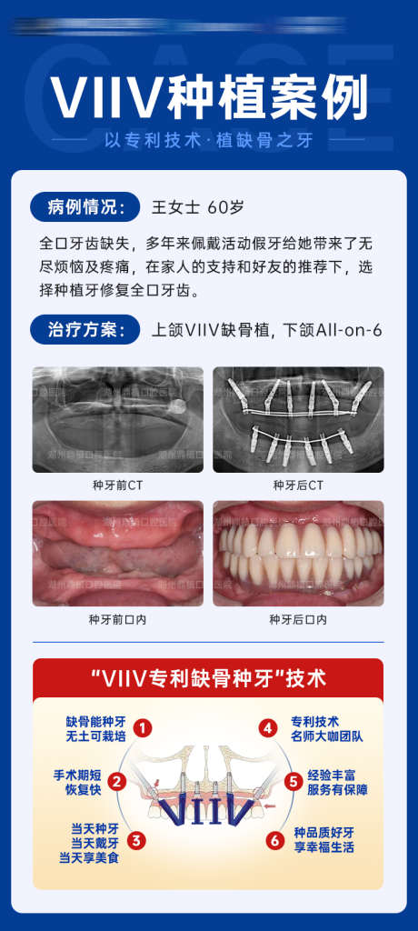 全口种植牙案例对比图海报_源文件下载_PSD格式_750X1670像素-医疗,牙科,口腔,技术,全口种植,海报,对比,案例,种植牙-作品编号:2024032910124056-素材库-www.sucai1.cn