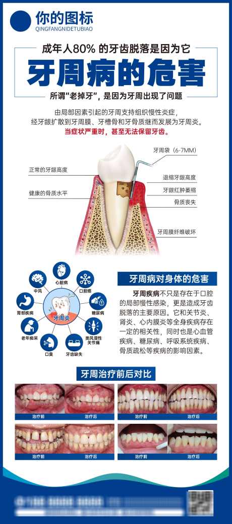 牙周活动展架_源文件下载_AI格式_2268X5102像素-口腔,牙科,牙周病,牙齿,牙周,活动,展架-作品编号:2024071213397762-志设-zs9.com