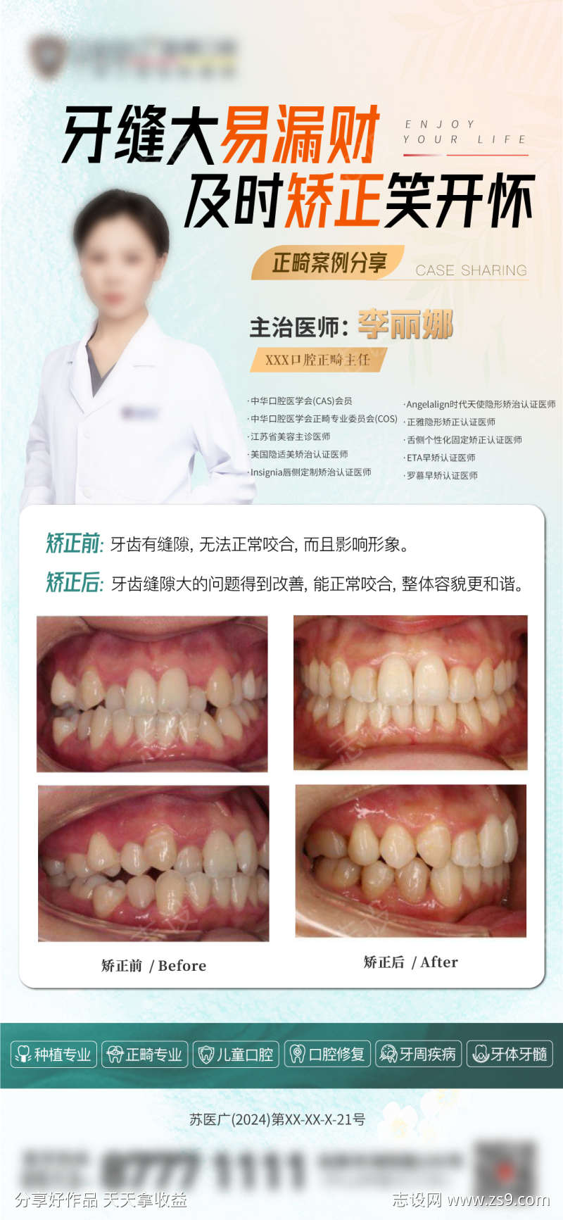 口腔医院正畸案例分享